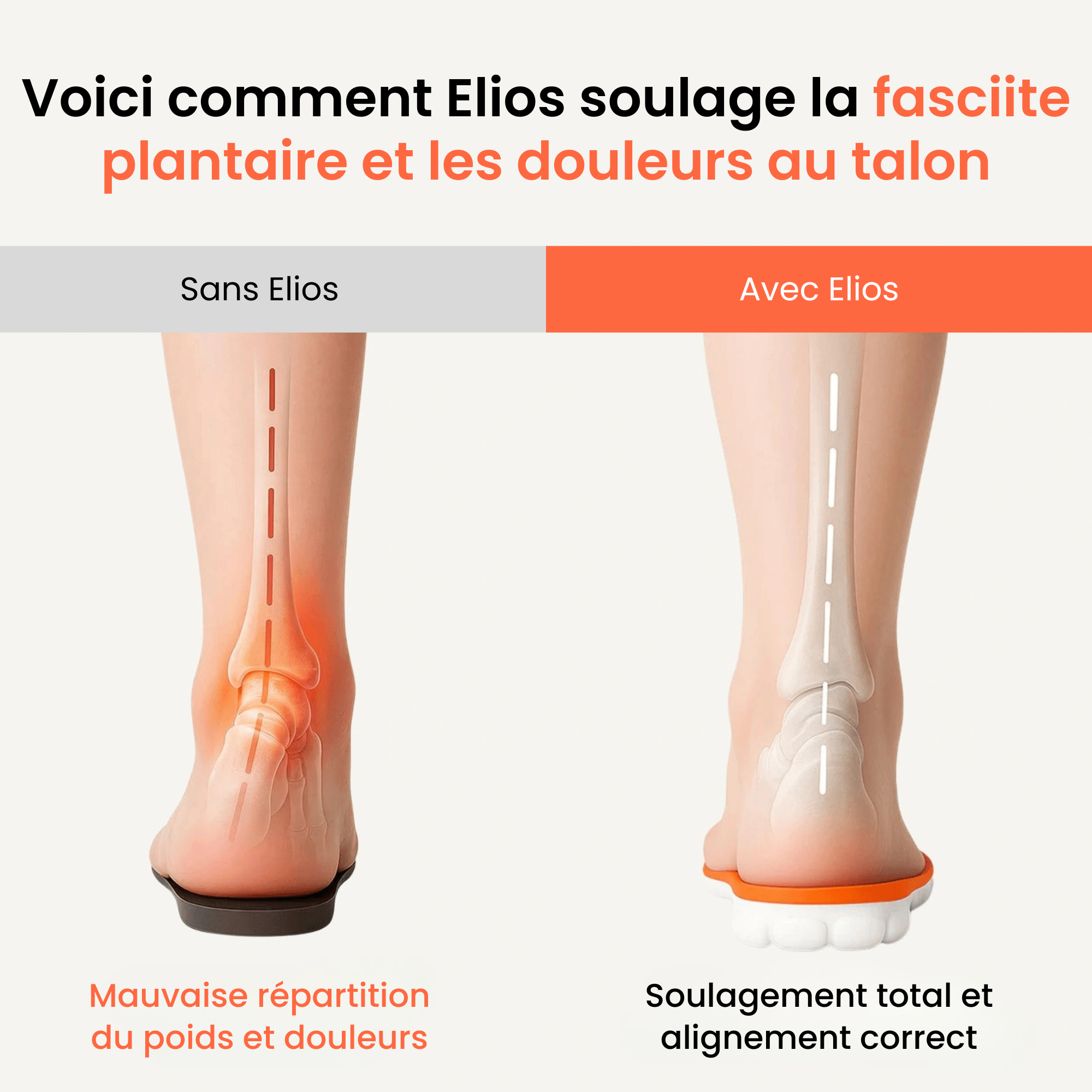Semelles orthopédiques pour soulager les douleurs au talon et la fasciite plantaire